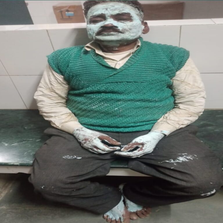 गैस पाइप फटने से घर में लगी आग, खाना बनाते समय युवक गंभीर रूप से झुलसा