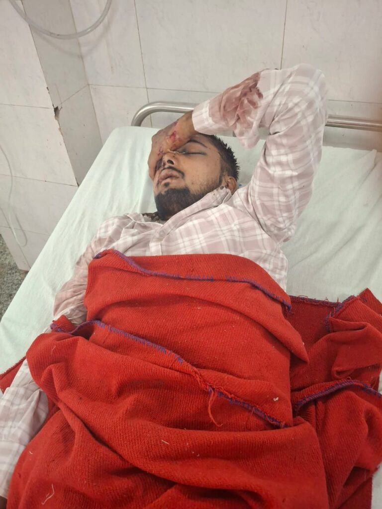 गौ तस्करों की तेज रफ्तार गाड़ी ने ली दो युवकों की जान, एक हफ्ते बाद दूसरे घायल की भी मौत, पुलिस की कार्रवाई पर उठे सवाल