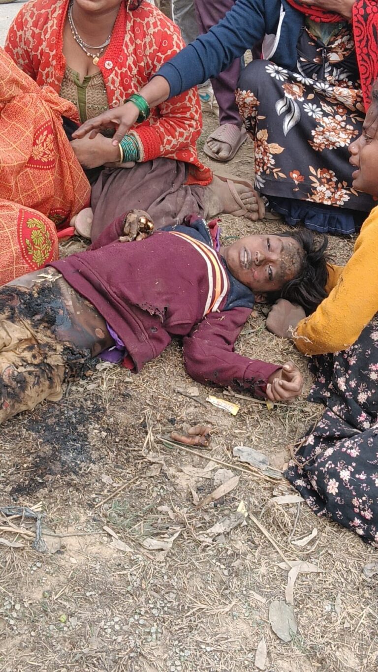 बिजली विभाग की लापरवाही से 11 वर्षीय बालक की दर्दनाक मौत, गांव में उबाल