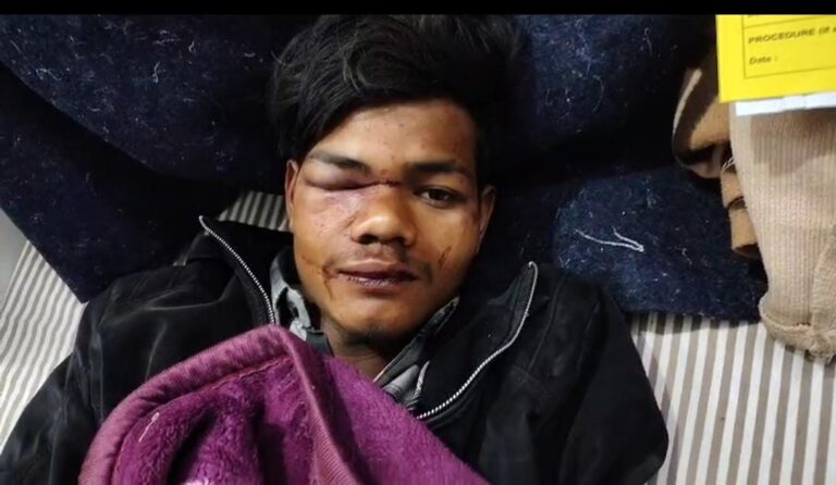 देवरिया में दबंगों का कहर, युवक की पिटाई का वीडियो सोशल मीडिया पर वायरल