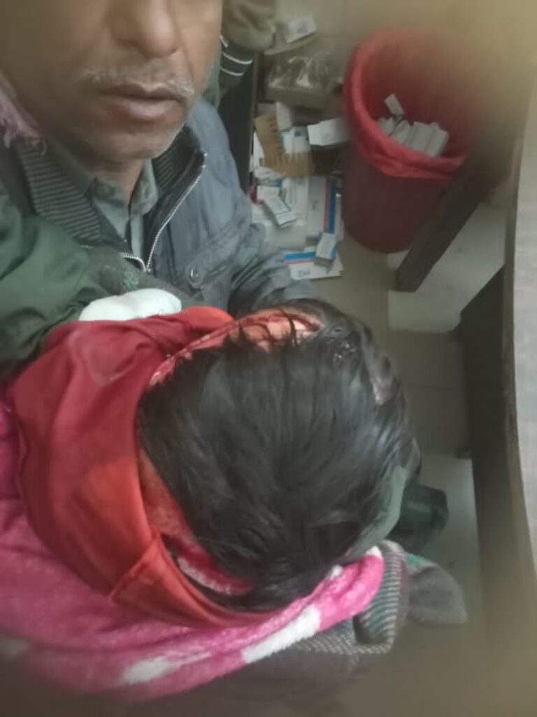 बहराइच: झोपड़ी में घुसा हिंसक जानवर, 7 वर्षीय श्याम मिश्रा गंभीर घायल