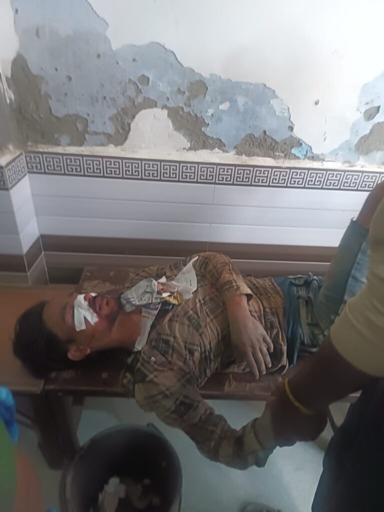 आमने-सामने की टक्कर में दो बाइक सवार घायल पुलिस ने पहुंचाया अस्पताल