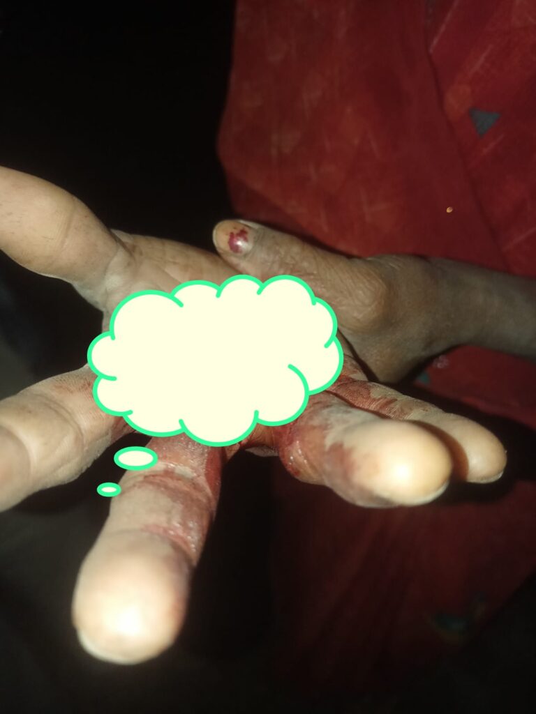 दबंगई की हद: दंपति पर चाकू-चेन से हमला, घर में घुसकर मारपीट का वीडियो वायरल
