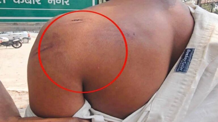 खाकी पर दाग! पुलिसकर्मियों पर मारपीट और 10 हजार वसूली का गंभीर आरोप