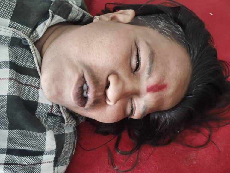 सड़क दुर्घटना मे दो युवक घायलदेवरिया रेफर