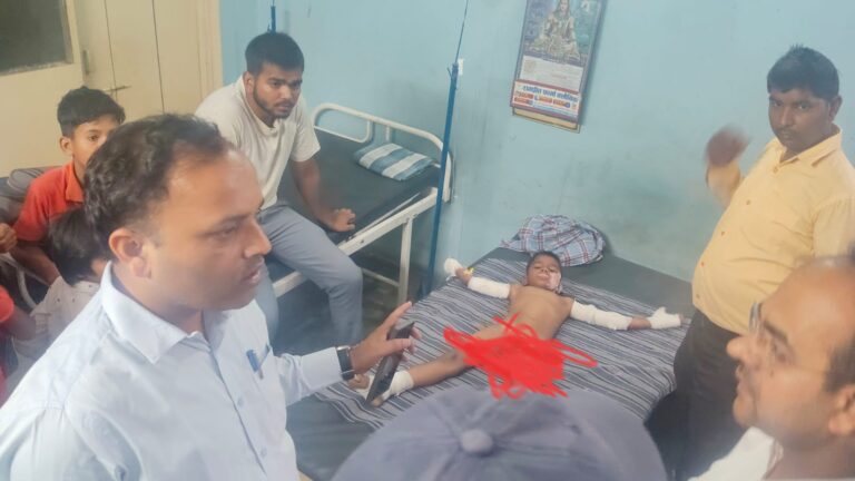 रामुडीह में गेहूं के डंठल में लगी आग से पांच बच्चे झुलसे