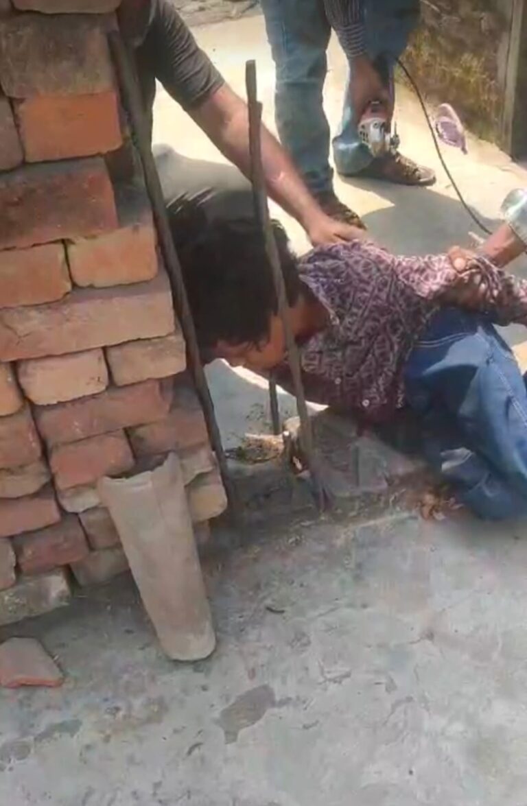 पतंग बनी काल: गोरखपुर में 14 साल के बच्चे के गले में आर-पार हुई सरिया