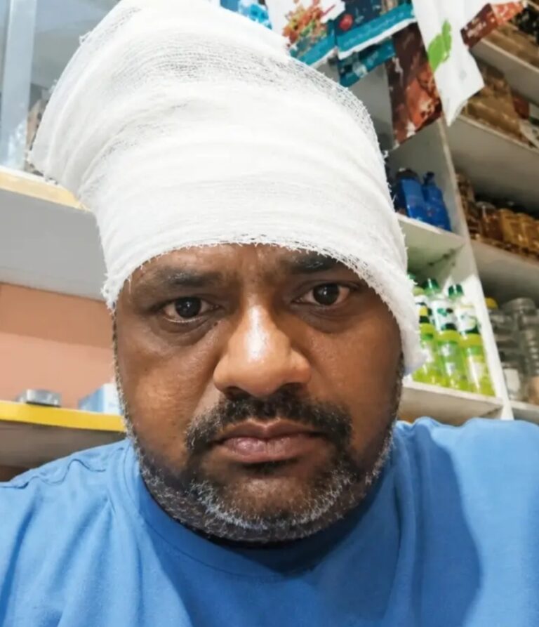 23 हजार रुपये ने तोड़े रिश्ते, भाइयों के बीच खूनी बवाल