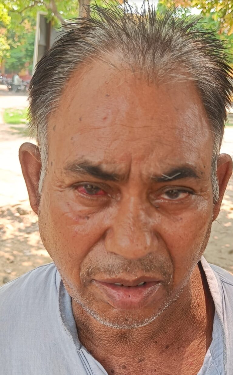 आम तोड़ने से मना करने पर शिक्षक की जमकर पिटाई